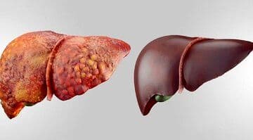 هشدار؛ غذا خوردن در ساعات پایانی شب باعث ابتلا به این بیماری خطرناک می شود